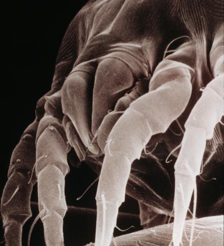 House dust mite, Dermatophagoides spp.  Photograph by: Acarology Laboratory, Ohio State University. 